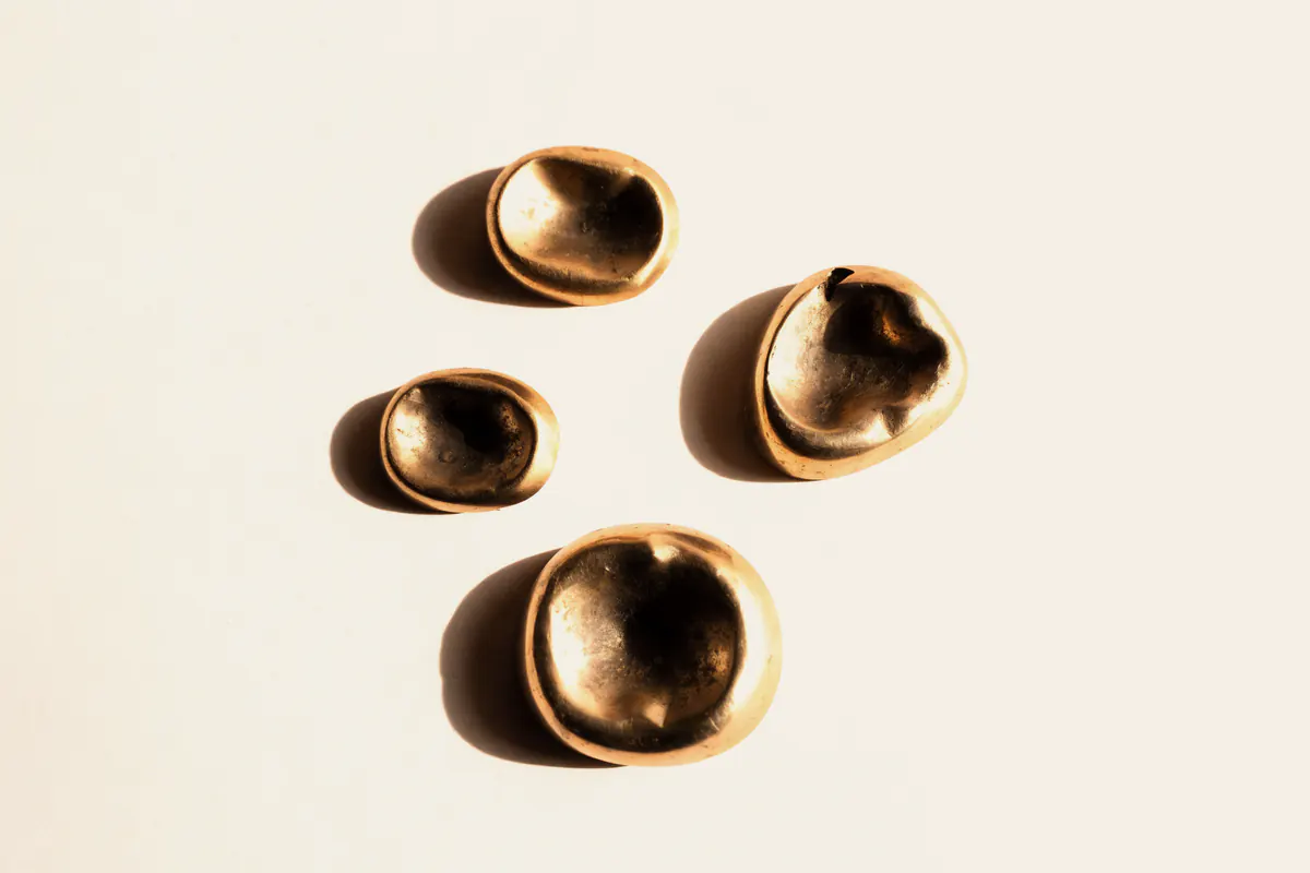 Was ist mein Zahngold wert?