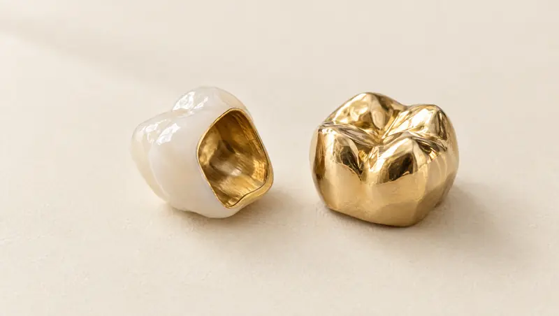 Keramikkrone mit Goldkern neben einer Goldkrone
